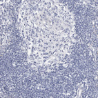 Anti-SLC22A12 Antibody