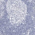 Immunohistochemical staining of human lymph node shows no positivity in lymphoid cells as expected.
