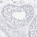 Immunohistochemical staining of human testis shows no positivity in cells in seminiferous ducts as expected.
