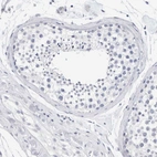 Immunohistochemical staining of human testis shows no positivity in cells in seminiferous ducts as expected.