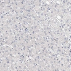 Immunohistochemical staining of human liver shows no positivity in hepatocytes as expected.