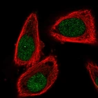Immunofluorescent staining of human cell line PC-3 shows localization to nucleoplasm.