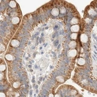 Immunohistochemical staining of human colon using Anti-HDHD3 antibody HPA024585.