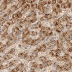 Immunohistochemical staining of human liver using Anti-HDHD3 antibody HPA024585.