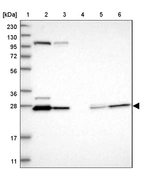 Lane 1: Marker [kDa] 230, 130, 95, 72, 56, 36, 28, 17, 11_br/_Lane 2: Human cell line RT-4_br/_Lane 3: Human cell line U-251MG sp_br/_Lane 4: Human plasma (IgG/HSA depleted)_br/_Lane 5: Human liver tissue_br/_Lane 6: Human tonsil tissue