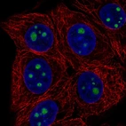 Immunofluorescent staining of human cell line MCF7 shows localization to nucleoli.
