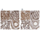 Anti-IARS2 Antibody