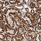 Immunohistochemical staining of human kidney shows strong granular cytoplasmic positivity in cells in tubules.