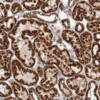 Immunohistochemical staining of human kidney shows strong granular cytoplasmic positivity in cells in tubules.