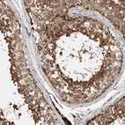 Immunohistochemical staining of human testis shows moderate granular cytoplasmic positivity in cells in seminiferous ducts.