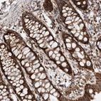 Immunohistochemical staining of human rectum shows strong granular cytoplasmic positivity in glandular cells.