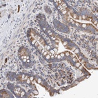 Anti-IARS2 Antibody