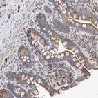 Anti-IARS2 Antibody