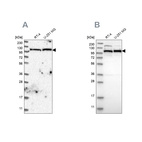 Western blot analysis using Anti-IARS2 antibody HPA024596 (A) shows similar pattern to independent antibody HPA024212 (B).