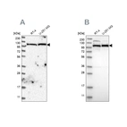 Western blot analysis using Anti-IARS2 antibody HPA024596 (A) shows similar pattern to independent antibody HPA024212 (B).