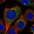 Immunofluorescent staining of human cell line A-431 shows localization to mitochondria.