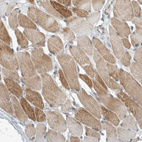 Immunohistochemical staining of human skeletal muscle shows moderate cytoplasmic positivity in myocytes.