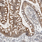 Immunohistochemical staining of human small intestine shows moderate cytoplasmic positivity in glandular cells.