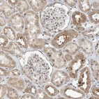 Immunohistochemical staining of human kidney shows weak to moderate cytoplasmic positivity in cells in tubules.