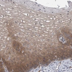 Immunohistochemical staining of human esophagus shows high expression.