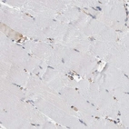 Immunohistochemical staining of human skeletal muscle shows low expression as expected.