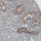 Immunohistochemical staining of human endometrium shows moderate cytoplasmic positivity in glandular cells.