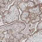 Immunohistochemical staining of human placenta shows moderate to strong cytoplasmic positivity in trophoblastic cells.