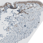 Immunohistochemical staining of human skin shows moderate cytoplasmic positivity in keratinocytes.