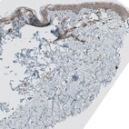 Immunohistochemical staining of human skin shows moderate cytoplasmic positivity in keratinocytes.
