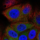 Immunofluorescent staining of human cell line MCF7 shows localization to mitochondria.