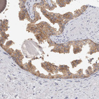 Anti-NEDD4L Antibody