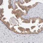 Immunohistochemical staining of human prostate shows moderate membranous positivity in glandular cells.