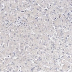 Immunohistochemical staining of human liver shows no positivity in hepatocytes as expected.