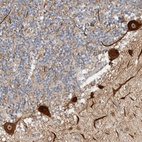 Anti-CEP295NL Antibody