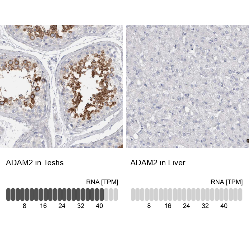 Anti-ADAM2 Antibody
