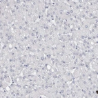 Immunohistochemical staining of human liver shows no positivity in hepatocytes as expected.