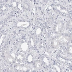 Immunohistochemical staining of human kidney shows no positivity in cells in tubules as expected.