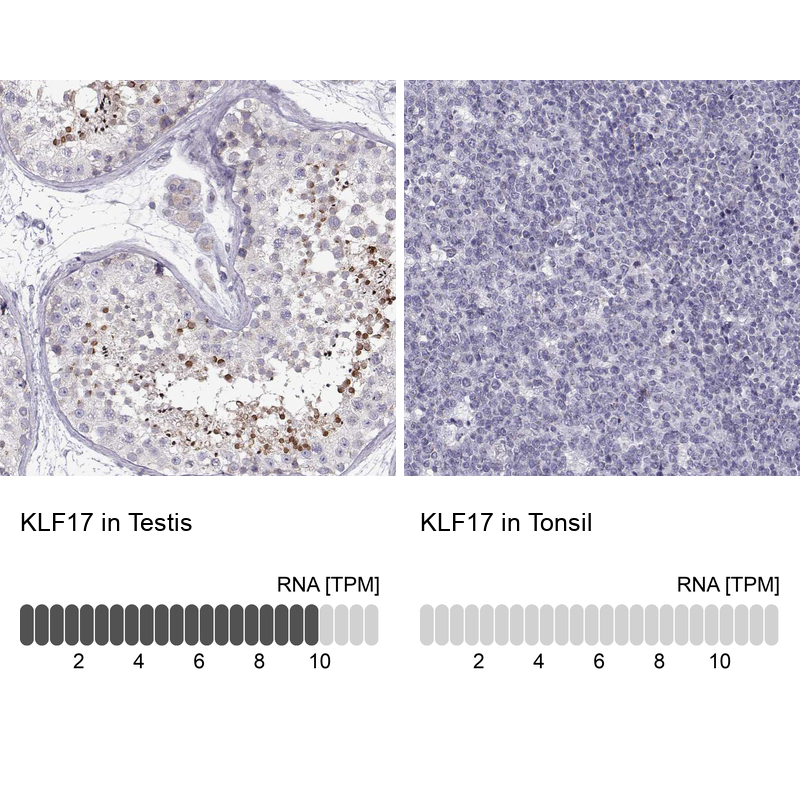 Anti-KLF17 Antibody