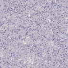 Immunohistochemical staining of human pancreas shows no nuclear positivity in exocrine glandular cells as expected.
