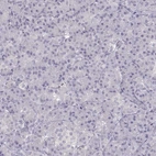 Immunohistochemical staining of human pancreas shows no nuclear positivity in exocrine glandular cells as expected.