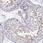 Immunohistochemical staining of human testis shows strong nuclear positivity in spermatids.