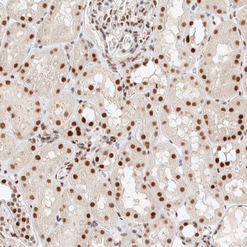 Anti-ZNF768 Antibody
