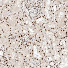 Anti-ZNF768 Antibody