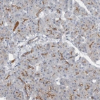 Anti-SLC38A10 Antibody