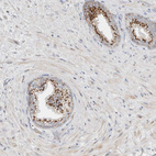 Immunohistochemical staining of human prostate shows strong granular cytoplasmic positivity in glandular cells.