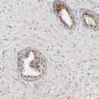 Immunohistochemical staining of human prostate shows strong granular cytoplasmic positivity in glandular cells.