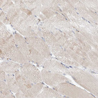 Immunohistochemical staining of human skeletal muscle shows very weak cytoplasmic positivity in myocytes.