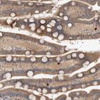 Anti-TARBP1 Antibody