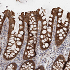 Immunohistochemical staining of human Colon shows moderate cytoplasmic positivity in glandular cells.