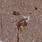 Immunohistochemical staining of human Pancreas shows moderate cytoplasmic positivity in islets of Langerhans.